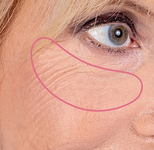 Load image into Gallery viewer, Silicone pads against wrinkles around the eyes and dark circles
